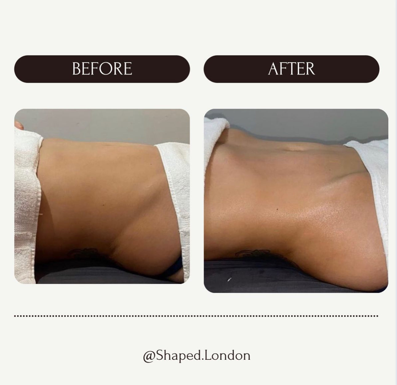 FULL BODY LYMPHATIC DRAINAGE (1 HOUR 30MINUTES) £80