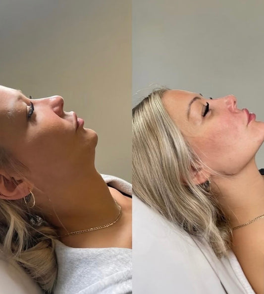 LYMPHATIC DRAINAGE POST-SURGICAL (ADD ON) 30MINS £30