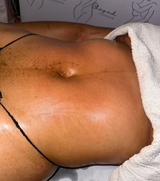 360 LYMPHATIC DRAINAGE - NON SURGICAL (1 HOUR) £55