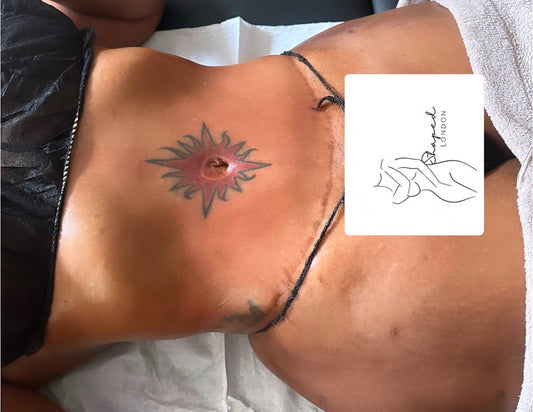 POST-SURGICAL CARE (1 HOUR) £55