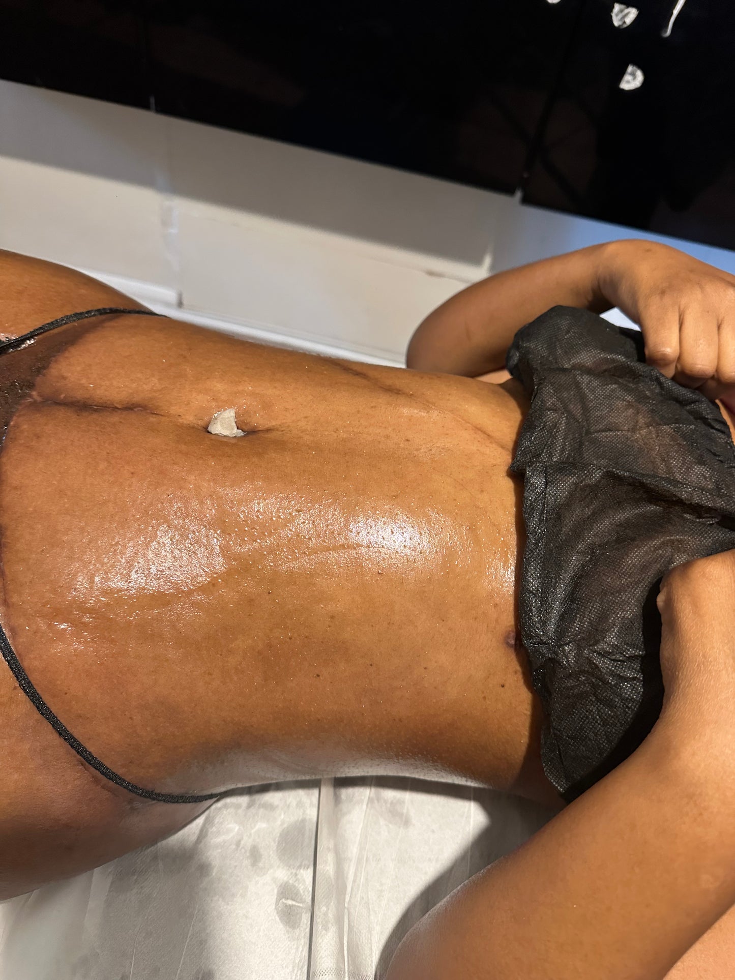 360 LYMPHATIC DRAINAGE - POST SURGICAL (1 HOUR) X6 £300