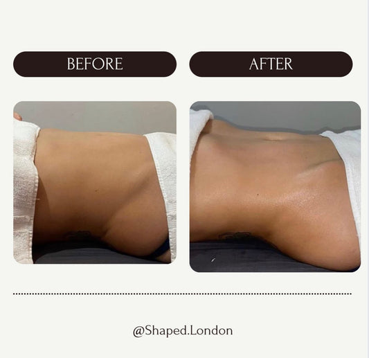 FULL BODY LYMPHATIC DRAINAGE (1 HOUR 30MINUTES) £80