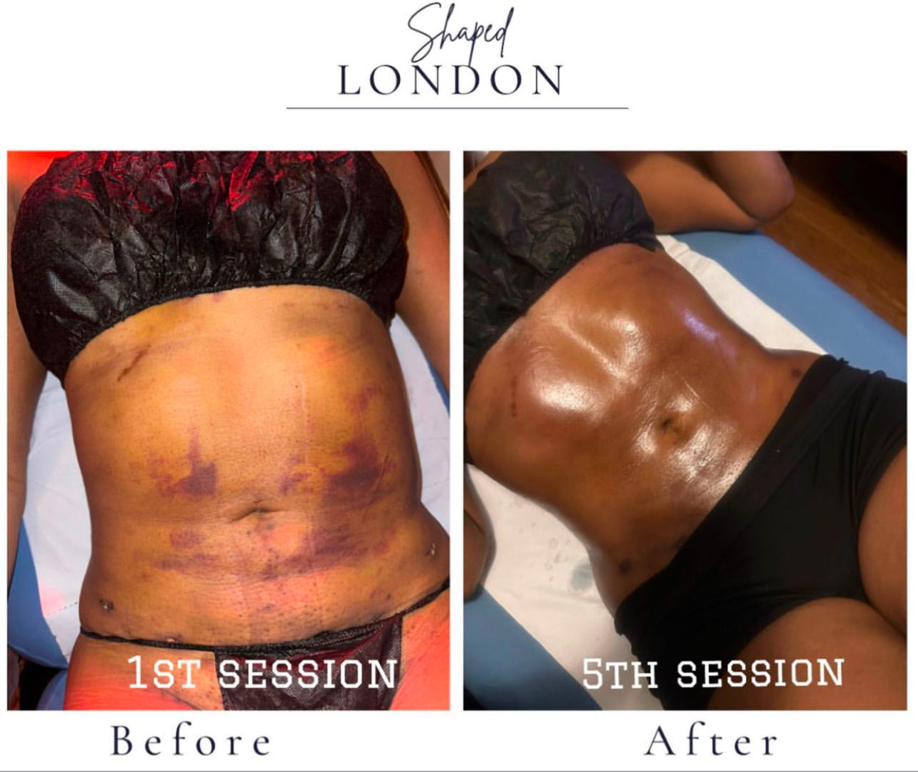 POST-SURGICAL CARE (1 HOUR) £55