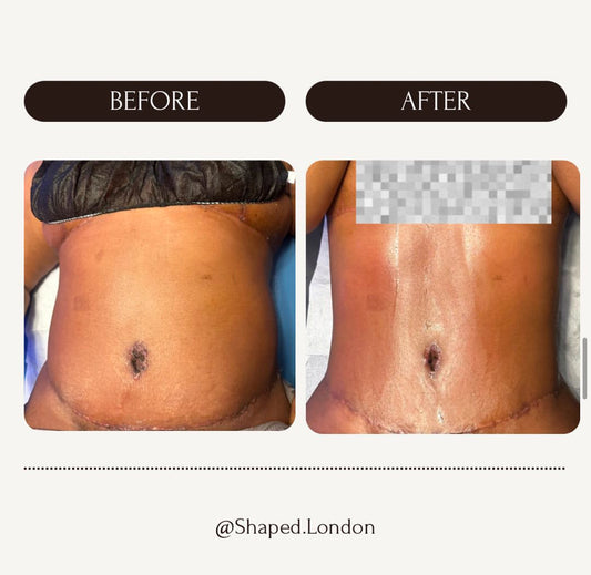 360 LYMPHATIC DRAINAGE  (1 HOUR X 10) £500