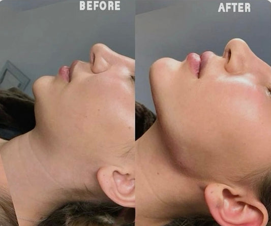 LYMPHATIC DRAINAGE POST-SURGICAL (ADD ON) 30MINS £30